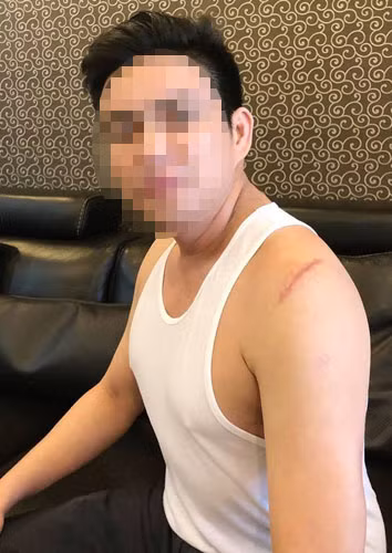 Bác sĩ Chiêm Quốc Thái, người bị nhóm 4 đối tượng bất ngờ dùng hung khí tấn công giữa trung tâm TP HCM.