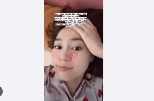 Ninh Duong Lan Ngoc tra gia vi thoi quen cuc xau khi bi mun