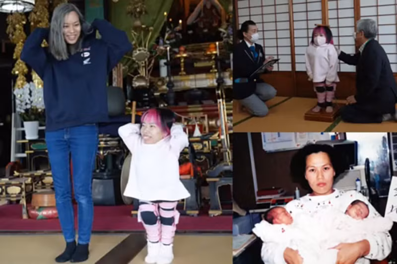 Cap sinh doi co chieu cao chenh lech nhat the gioi