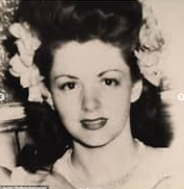 Những ca phẫu thuật thẩm mỹ thất bại của showbiz - Hình 2 Nhung ca phau thuat tham my that bai cua showbiz-Hinh-2