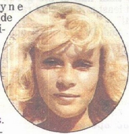 Những ca phẫu thuật thẩm mỹ thất bại của showbiz Nhung ca phau thuat tham my that bai cua showbiz