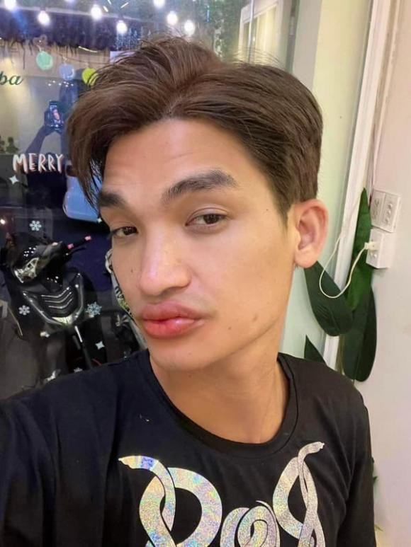 Mạc Văn Khoa đi làm đẹp, kết quả khiến con gái nhìn là khóc - Hình 2 Mac Van Khoa di lam dep, ket qua khien con gai nhin la khoc-Hinh-2