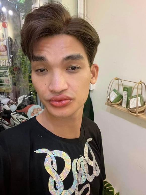 Mạc Văn Khoa đi làm đẹp, kết quả khiến con gái nhìn là khóc Mac Van Khoa di lam dep, ket qua khien con gai nhin la khoc