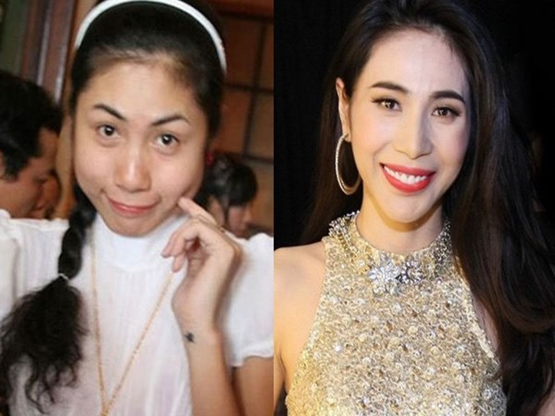 Sau một thời gian bước vào showibz, Thủy Tiên có sự thay đổi ngoạn mục về nhan sắc. Thuở mới ca hát, cô có gương mặt tròn bầu bĩnh sau đó trở nên thon gọn hơn. Nhiều lần, Thủy Tiên bị nghi độn cằm, gọt hàm. Về phần mình, Thủy Tiên chưa từng thừa nhận dao kéo. Ảnh: Dân Việt