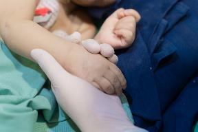 VINMEC ghép gan thành công cho bệnh nhi 8 tháng tuổi - Hình 5 VINMEC ghep gan thanh cong cho benh nhi 8 thang tuoi-Hinh-5