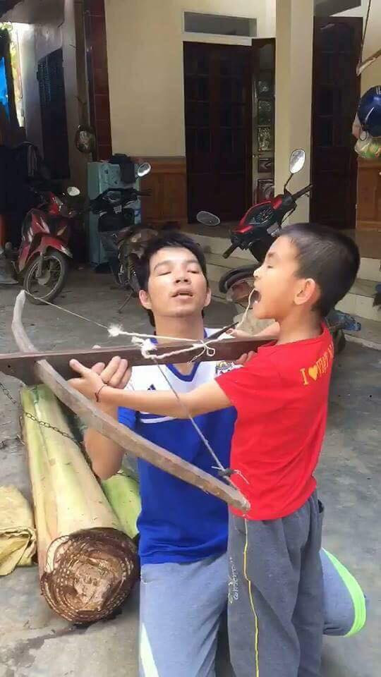 Phương pháp nhổ răng bất hủ gây bão mạng xã hội.