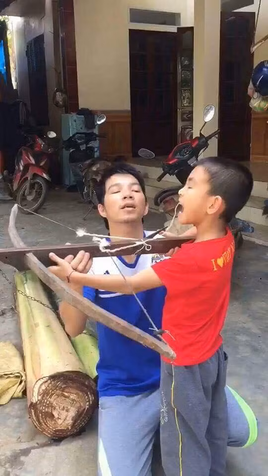 Phương pháp nhổ răng bất hủ gây bão mạng xã hội.