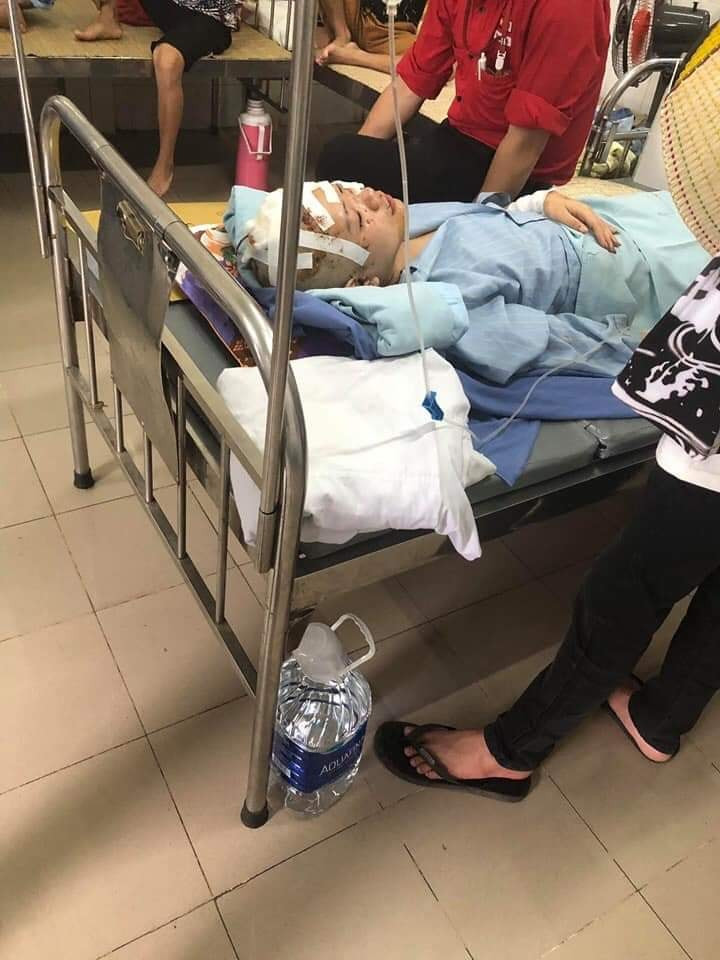 Thân thể nữ sinh xinh đẹp giờ chi chít vết thương sau vụ tai nạn.