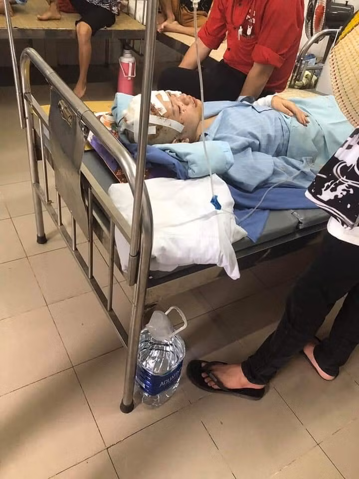 Thân thể nữ sinh xinh đẹp giờ chi chít vết thương sau vụ tai nạn.