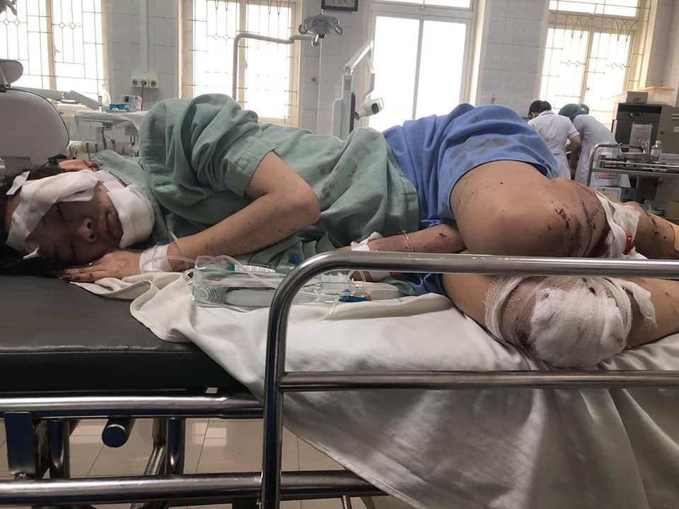 Trong cơn mê sảng, Thu vẫn gọi tên bạn mình và em gái sắp thi THPT 2019 bị tai nạn.