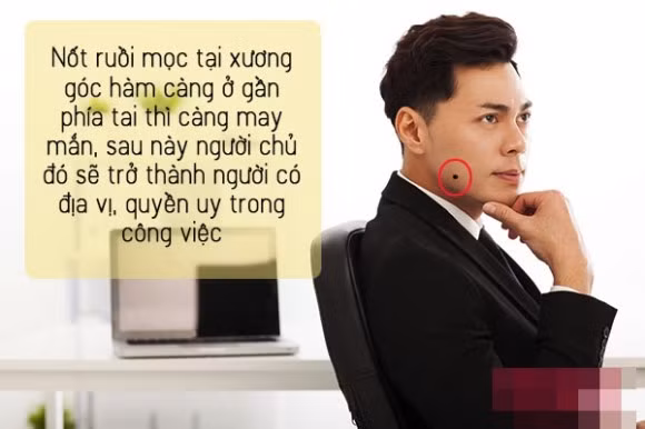 5. Nốt ruồi ở góc hàm Các quý cô, quý anh có chiếc cằm bạnh nếu được “khuyến mãi” thêm một nốt ruồi (son) ở càng gần phía tai thì càng may mắn. Sau này họ sẽ trở thành người có địa vị, quyền uy trong công việc. Ngược lại, nếu đó là một vết bớt, một nốt ruồi quá to thì họ là tuýp người nhẹ dạ cả tin điển hình. Người như thế thậm chí còn rất dễ bị đồng nghiệp bán đứng, người yêu phản bội, bạn bè lường gạt. Cả đời long đong lận đận, khốn khổ vô cùng.