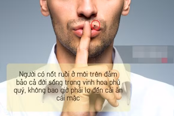 3. Nốt ruồi ở môi trên Đừng nghe các cụ nói rằng: “Nốt ruồi ở môi ăn trôi cả nhà” mà lo sợ bạn nhé. Ai là chủ sở hữu nốt ruồi ở ngay môi trên, nên nhớ là nốt ruồi nho nhỏ, xinh xắn thôi, thì đảm bảo cả đời sống trong vinh hoa phú quý, không bao giờ phải lo đến cái ăn cái mặc. Là nữ thì sẽ sớm lấy được chồng giàu, sống trong nhung lụa tựa như đệ nhất phu nhân. Là nam thì nên chú ý đến làm ăn, sau khi kết hôn công việc và tiền tài sẽ thay đổi vượt bậc. Chủ nhân của nốt ruồi này cần chú ý đến lời ăn tiếng nói, “uốn lưỡi bảy lần trước khi nói”. Và nên đặc biệt tránh các yếu tố Thủy, kiêng đi xa bằng đường sông nước để tránh rước họa vào thân.