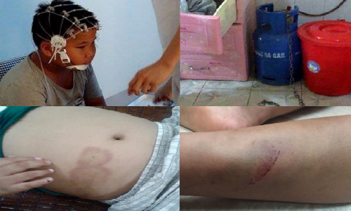 10. Nghi án bé trai 9 tuổi bị bố đẻ, mẹ kế bạo hành Nhiều ngày qua, dư luận vô cùng bức xúc trước hình ảnh cháu bé Lưu Gia .K. (9 tuổi, trú tại thôn Lim, xã Giáp Sơn, huyện Lục Ngạn, Bắc Giang) bị đánh đập, hành hạ dã man được đăng tải trên mạng xã hội. Mẹ ruột của cháu L. đã tố cáo cháu bị chính bố đẻ và mẹ kế bạo hành. 