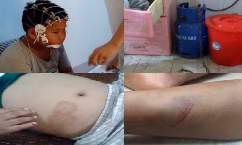 10. Nghi án bé trai 9 tuổi bị bố đẻ, mẹ kế bạo hành Nhiều ngày qua, dư luận vô cùng bức xúc trước hình ảnh cháu bé Lưu Gia .K. (9 tuổi, trú tại thôn Lim, xã Giáp Sơn, huyện Lục Ngạn, Bắc Giang) bị đánh đập, hành hạ dã man được đăng tải trên mạng xã hội. Mẹ ruột của cháu L. đã tố cáo cháu bị chính bố đẻ và mẹ kế bạo hành. 