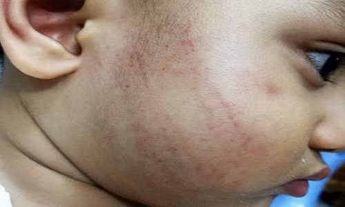 Dong Nai: Co giao mam non tat tre tham tim mat