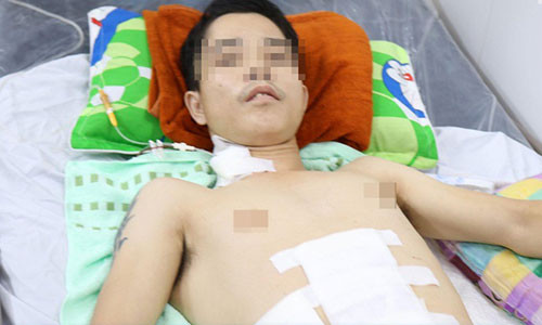 Cuu nguoi dan ong bi dam vao bung