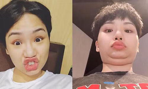 Nữ ca sĩ Miu Lê dường như không đối thủ trong việc làm mặt xấu rồi công khai hình ảnh. Ảnh: Saostar