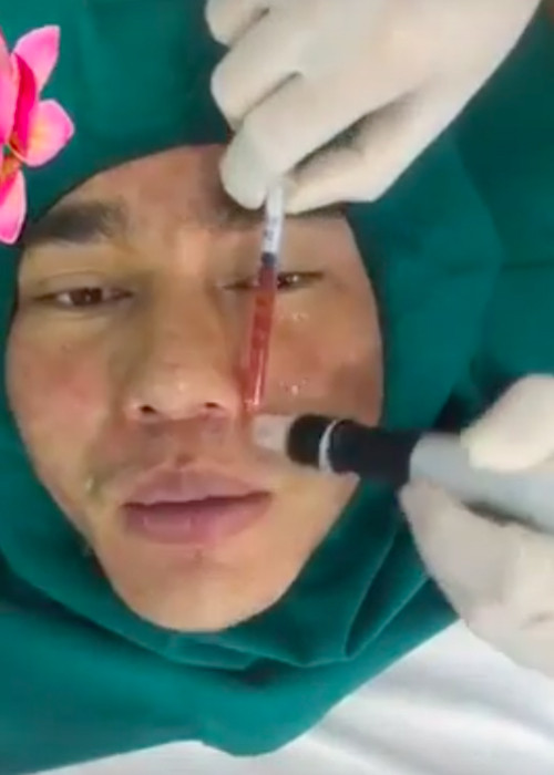 Anh có sở thích mỗi năm làm một bộ răng sứ mới. Ảnh: Vietnamnet