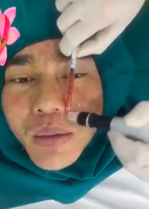 Anh có sở thích mỗi năm làm một bộ răng sứ mới. Ảnh: Vietnamnet