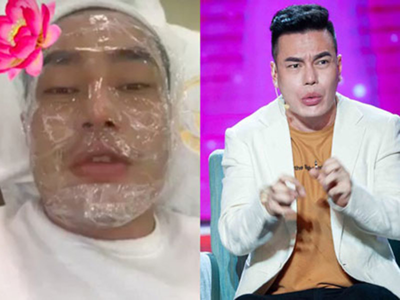 Lê Dương Bảo Lâm tiết lộ, cứ 10 ngày là anh phải đi thẩm mỹ một lần, cưa hết răng cũ đi thay răng mới, đau đớn vô cùng. Ảnh: Vietnamnet