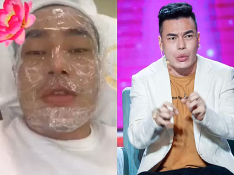 Lê Dương Bảo Lâm tiết lộ, cứ 10 ngày là anh phải đi thẩm mỹ một lần, cưa hết răng cũ đi thay răng mới, đau đớn vô cùng. Ảnh: Vietnamnet