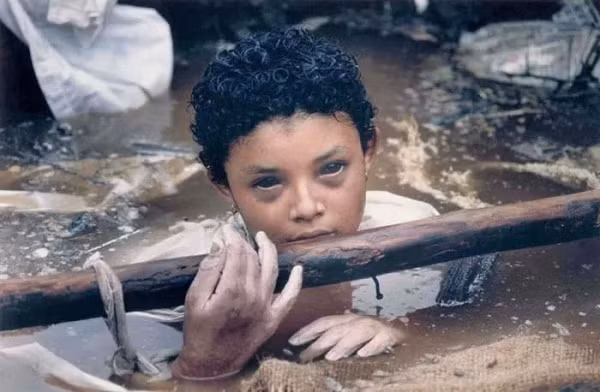 Omayra Sanchez, 13 tuổi, hai chân bị kẹt dưới bức tường gạch khi núi lửa Nevado del Ruiz ở Colombia phun trào. Không thể thực hiện một ca cắt cụt chi an toàn và giải thoát cho Omayra, các bác sĩ và lực lượng cứu hộ cho rằng, điều nhân đạo nhất là giữ cho cô bé bình tĩnh và để cô ấy chết dần.