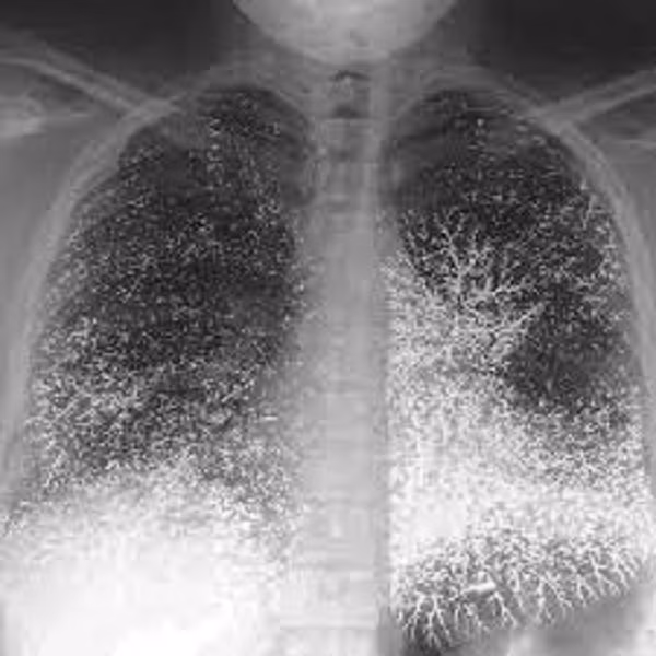 Tuy nhiên, quyết định của Gia Luật A Bảo Cơ lại gặp phải sự phản đối của nhiều người, trong đó vợ, em rể ông và con gái Chí Cổ là những người phản đối kịch liệt nhất. Vì vậy nàng đã bị cha ruột giam cầm dưới địa lao. Và, lượng thủy ngân mà đội khảo cổ tìm được rất có khả năng là lượng thuốc độc mà công chúa Chí Cổ đã uống để tự sát.