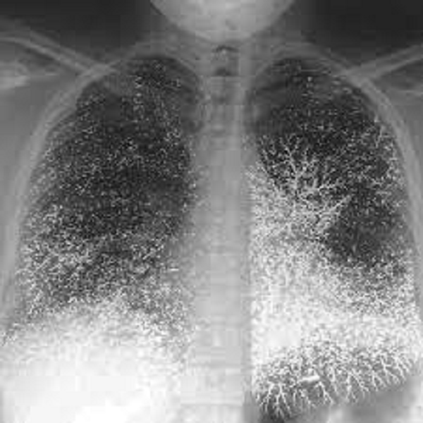 Tuy nhiên, quyết định của Gia Luật A Bảo Cơ lại gặp phải sự phản đối của nhiều người, trong đó vợ, em rể ông và con gái Chí Cổ là những người phản đối kịch liệt nhất. Vì vậy nàng đã bị cha ruột giam cầm dưới địa lao. Và, lượng thủy ngân mà đội khảo cổ tìm được rất có khả năng là lượng thuốc độc mà công chúa Chí Cổ đã uống để tự sát.