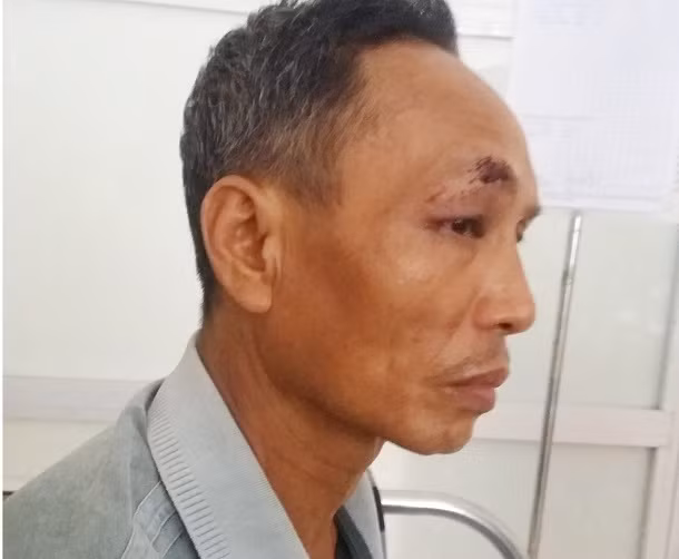 Dan to bi cong an danh, Truong Cong an huyen noi gi?