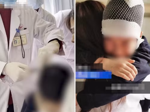 Giao vien tieu hoc keo toc nam sinh khien xuong so u mau