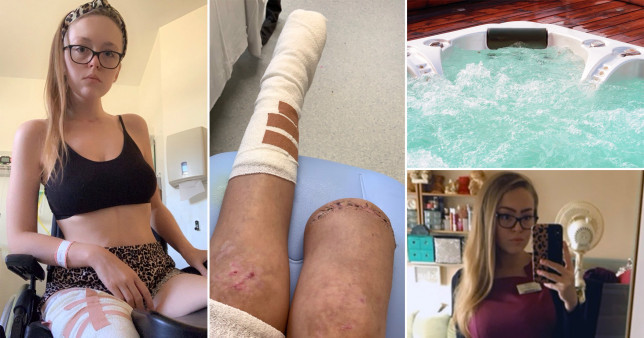 Nhau say ngu quen, gai tre soc nang khi tinh day thay chan bi cua cut