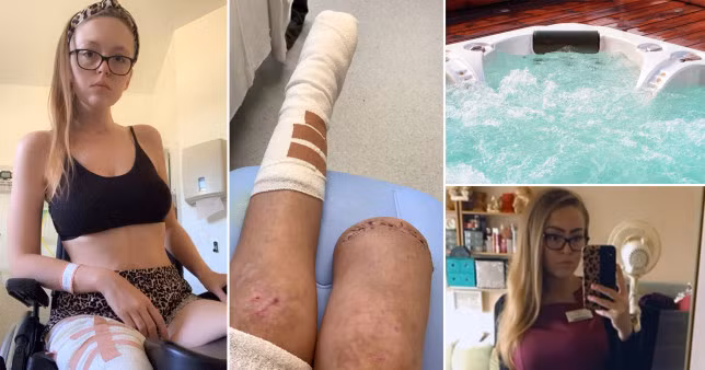 Nhau say ngu quen, gai tre soc nang khi tinh day thay chan bi cua cut