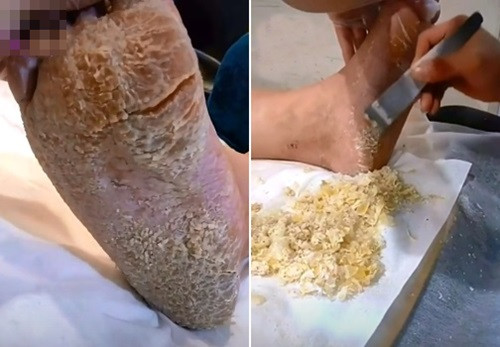 Chuyen gia lam dep het hon voi ban chan nhu “nguoi dat” cua khach hang