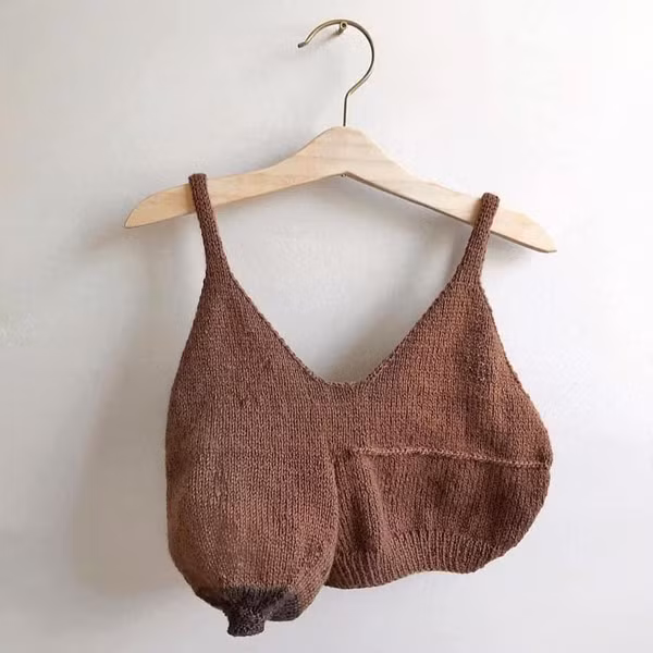 May mắn không bị “mướp”, bầu ngực của mẹ bỉm sữa này lại biến dạng đến thảm hại.