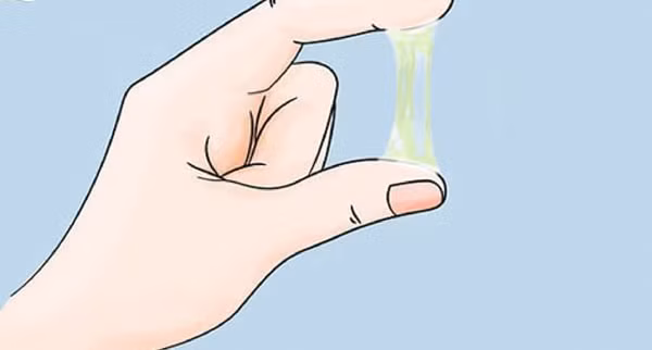 Tiết dịch bất thường vùng kín. Quan sát dịch tiết vùng kín biểu hiện trên quần lót có thể nhận diện được dấu hiệu bệnh phụ khoa, trong đó có ung thư cổ tử cung.