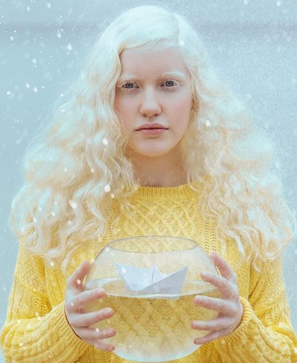 Những người bị bệnh bạch tạng luôn cảm thấy tự ti vì luôn nhận được ánh mắt tò mò, dò xét của những người xung quanh. Vậy nhưng, với Yulia lại khác.