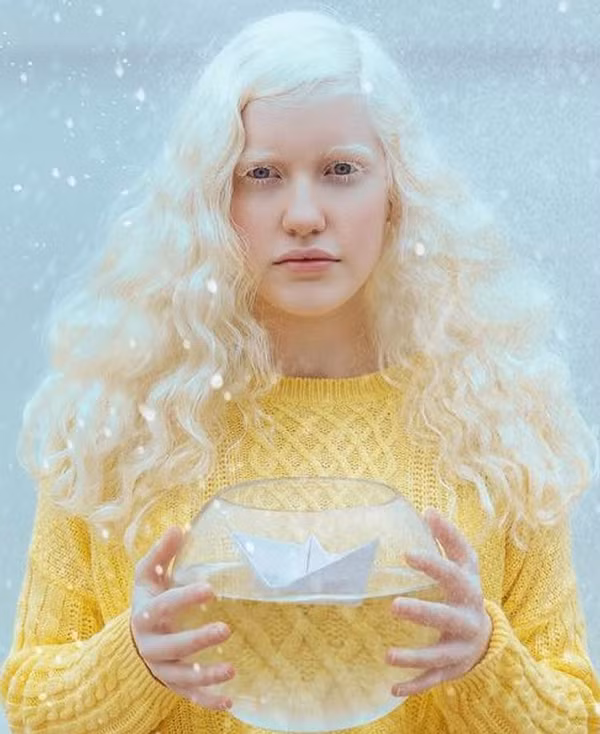 Những người bị bệnh bạch tạng luôn cảm thấy tự ti vì luôn nhận được ánh mắt tò mò, dò xét của những người xung quanh. Vậy nhưng, với Yulia lại khác.