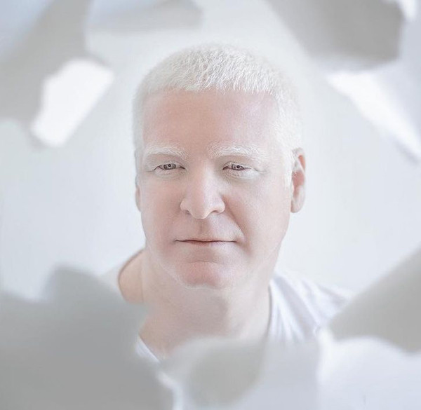 So với những nơi khác, bạch tạng diễn ra nhiều ở châu Phi với tỉ lệ 1:10.000.