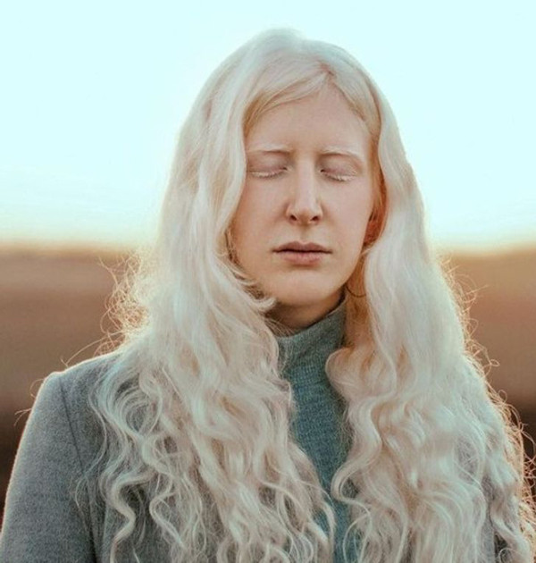 Bạch tạng là một thuật ngữ dùng chung cho các chứng bẩm sinh do rối loạn quá trình sinh tổng hợp ra sắc tố melanin, làm cho da, tóc và mắt của người bệnh có màu nhạt.