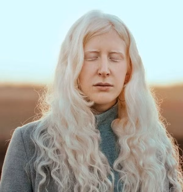 Bạch tạng là một thuật ngữ dùng chung cho các chứng bẩm sinh do rối loạn quá trình sinh tổng hợp ra sắc tố melanin, làm cho da, tóc và mắt của người bệnh có màu nhạt.