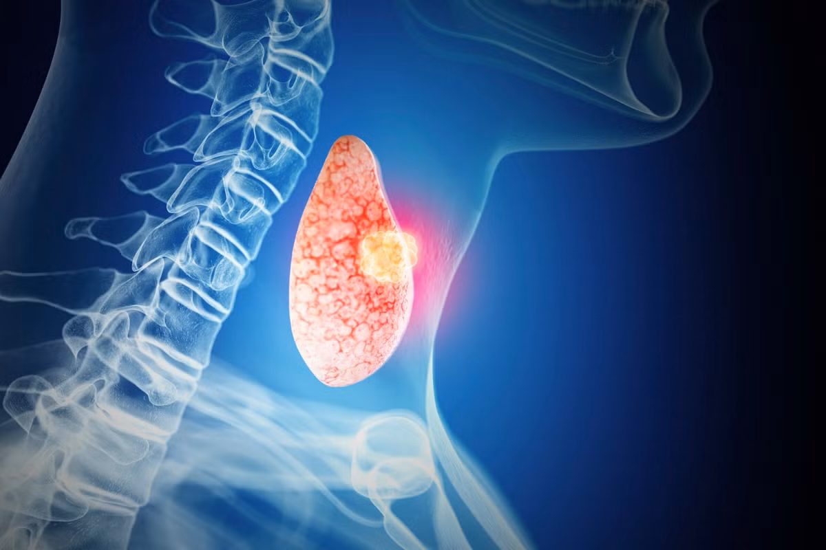 Dung gung qua lieu, nhung nguoi mac cac benh ly nay de gap hoa-Hinh-4