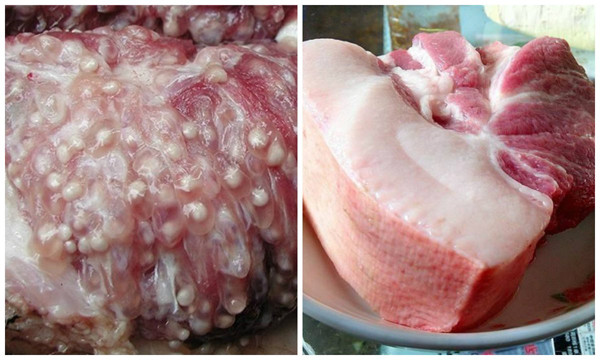 Hạch bạch huyết. Hạch bạch huyết là một phần quan trọng của hệ miễn dịch, giúp chống lại tình trạng nhiễm trùng. Quá trình hoạt động, chức năng của hạch là lọc bạch huyết và loại bỏ vi khuẩn nên có khả năng nhiều chất độc hại sẽ tích tụ bên trong.