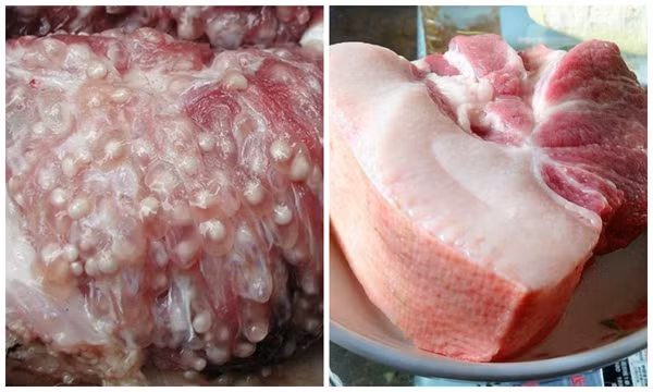 Hạch bạch huyết. Hạch bạch huyết là một phần quan trọng của hệ miễn dịch, giúp chống lại tình trạng nhiễm trùng. Quá trình hoạt động, chức năng của hạch là lọc bạch huyết và loại bỏ vi khuẩn nên có khả năng nhiều chất độc hại sẽ tích tụ bên trong.