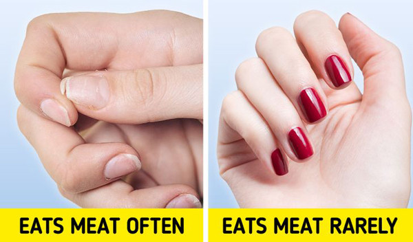 Các vấn đề về tóc và da. Thịt động vật gần như không chứa nhiều vitamin C. Trong khi đó, vitamin C đóng vai trò quan trọng trong việc hình thành collagen – một loại protein giúp da, tóc, móng, xương trở nên khỏe đẹp.