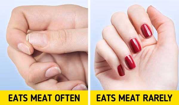 Các vấn đề về tóc và da. Thịt động vật gần như không chứa nhiều vitamin C. Trong khi đó, vitamin C đóng vai trò quan trọng trong việc hình thành collagen – một loại protein giúp da, tóc, móng, xương trở nên khỏe đẹp.