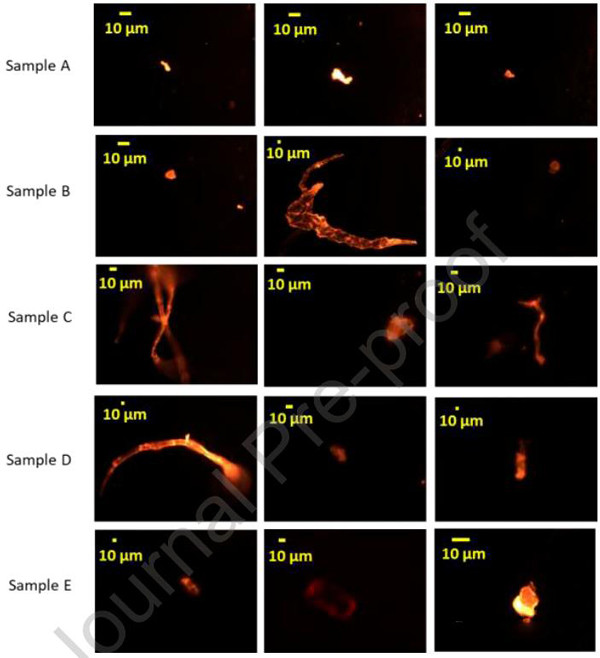 Theo Cơ quan Hóa chất Châu Âu, vi nhựa là vật liệu bao gồm các hạt rắn chứa polyme có đường kính nhỏ hơn 5mm. Các thành phần chính bao gồm polyetylen, polypropylen, polystyren, polyvinyl clorua, axit polylactic và Polyetylen terephthalate... Nó không hòa tan trong nước hoặc phân hủy sinh học. Đáng nói, nếu tiêu thụ các chất vi nhựa lâu dại có thể ảnh hưởng nghiêm trọng đến sức khỏe.