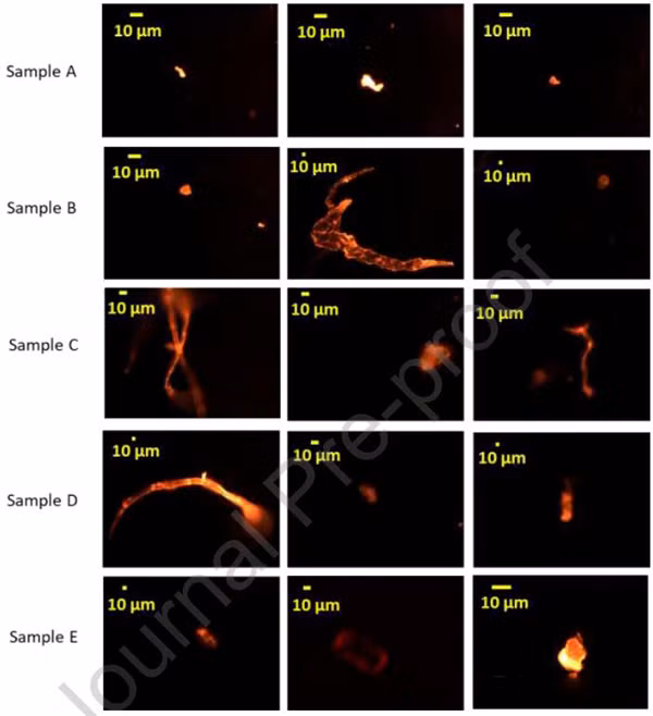 Theo Cơ quan Hóa chất Châu Âu, vi nhựa là vật liệu bao gồm các hạt rắn chứa polyme có đường kính nhỏ hơn 5mm. Các thành phần chính bao gồm polyetylen, polypropylen, polystyren, polyvinyl clorua, axit polylactic và Polyetylen terephthalate... Nó không hòa tan trong nước hoặc phân hủy sinh học. Đáng nói, nếu tiêu thụ các chất vi nhựa lâu dại có thể ảnh hưởng nghiêm trọng đến sức khỏe.