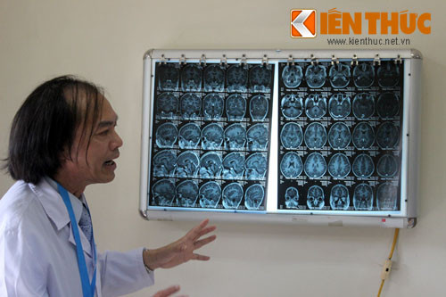 PGS.TS Nguyễn Tiến Dũng chiếu lại hình ảnh bệnh của cháu Hoàng.