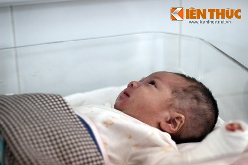 "Sau 5 ngày tích cực điều trị, da cháu bé vẫn bị nhiễm trùng, sốt nên các bác sĩ phải điều trị cho cháu bằng kháng sinh và chăm sóc trong môi trường cách ly. Đến nay, sau gần một tháng được các y bác sĩ trong BV Nhi Trung ương tích cực điều trị theo chuyên khoa da liễu, những vết lở loét trên người cháu Vũ đã bớt đi, sức khỏe của cháu cũng dần tạm ổn", T.S, B.S Lê Thị Hà - Phó khoa Hồi sức cấp cứu sơ sinh BV Nhi Trung ương cho hay.