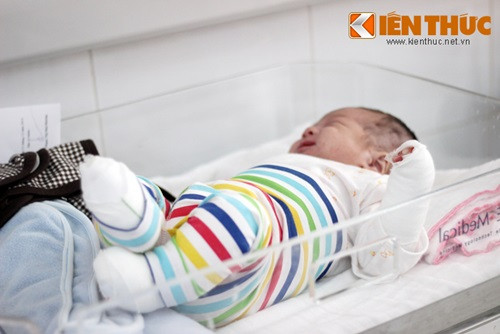 Suc khoe be so sinh bi bo roi, lo loet khap nguoi dang dan on dinh